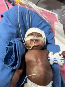 Baby of Madhuri 225x300